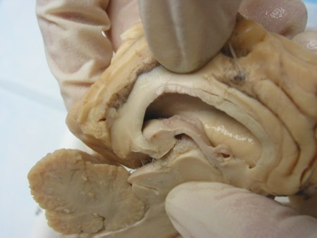 Sheep Brain Dissection 3